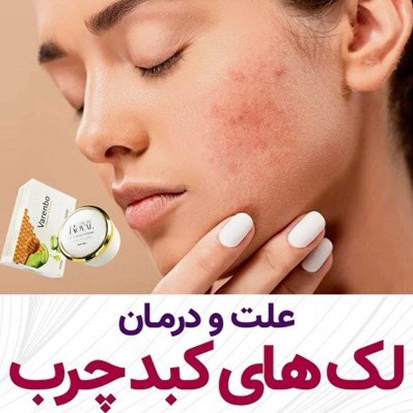  علائم خطرناک کبد چرب
