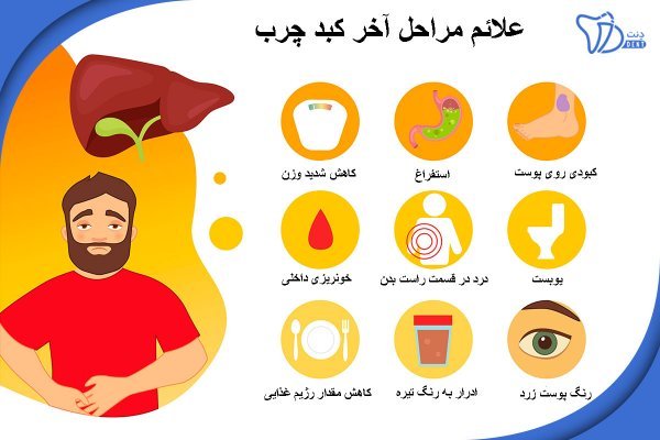  علائم خطرناک کبد چرب
