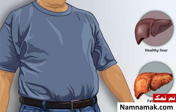  علائم خطرناک کبد چرب