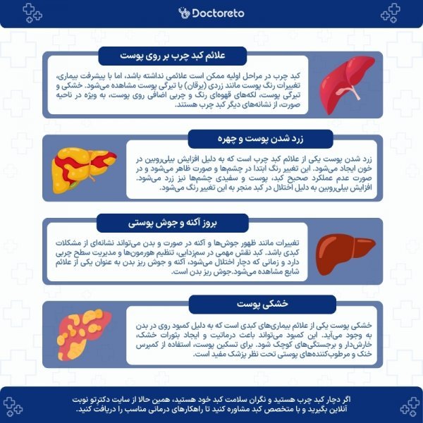  علائم خطرناک کبد چرب