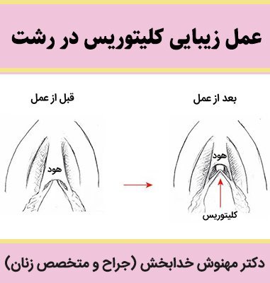  ارگاسم بانوان از طریق تحریک واژن است یا کلیتوریس؟ + عمل زیبایی کلیتوریس