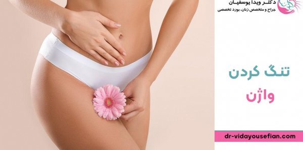  اسم قرص تنگ کننده واژن + ژل تنگ کننده واژن فوری + تغذیه برای سفت شدن کمر زن