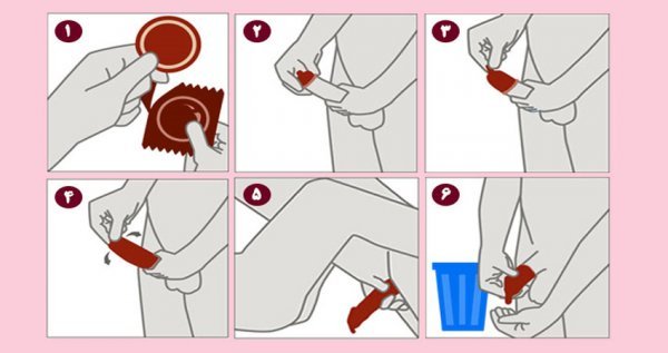  آیا کاندوم جلوی HPV را می‌گیرد؟ + چگونگی استفاده از کاندوم