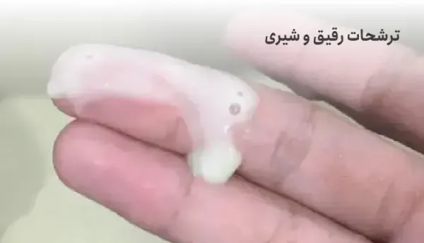  علت شور بودن ترشحات واژن + فواید خوردن ترشحات زن