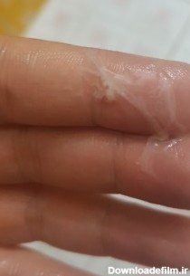  علت شور بودن ترشحات واژن + فواید خوردن ترشحات زن