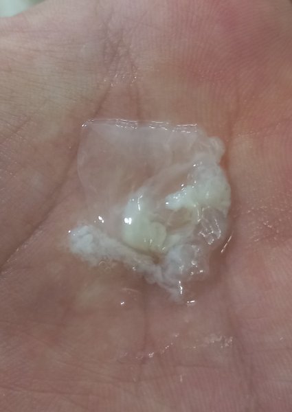  علت شور بودن ترشحات واژن + فواید خوردن ترشحات زن