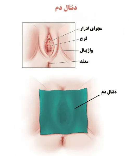  حکم مالش واژن توسط همسر از نظر اسلام + دخول با میوه از نظر اسلام