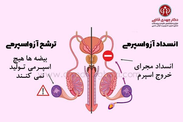  چی بخورم دیر ارضا بشم+غسل جنابت بدون آب+دلیل زود ارضا شدن در بعضی مردان