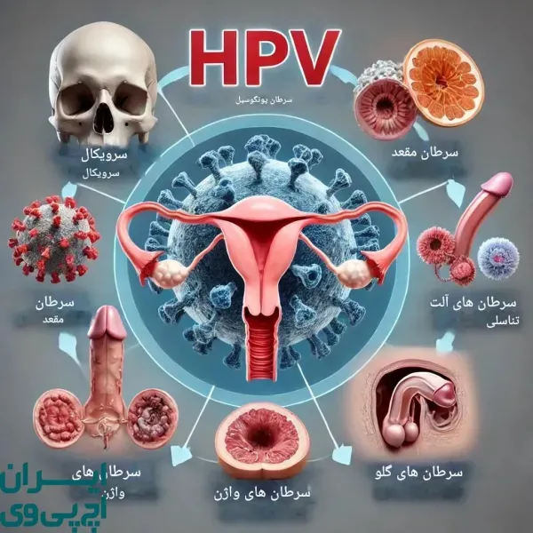  راهکار برای درد واکسن گارداسیل +واکسن HPV از کجا بخرم+ویروسHPVکشنده است