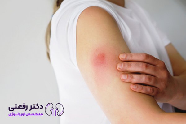  راهکار برای درد واکسن گارداسیل +واکسن HPV از کجا بخرم+ویروسHPVکشنده است