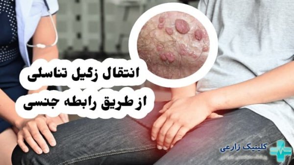 آیا HPV با یک‌ بار سکس منتقل می‌شود+ابتلا به ویروس HPV+ازمایش خون وHPV