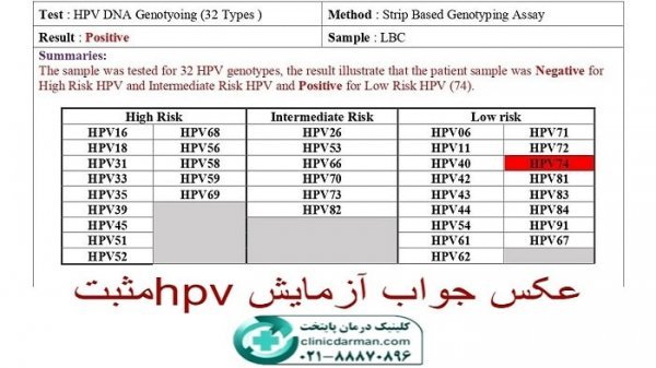  آیا HPV با یک‌ بار سکس منتقل می‌شود+ابتلا به ویروس HPV+ازمایش خون وHPV