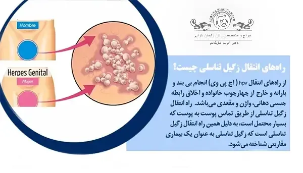  بعد از واکسن HPV می‌شود سکس داشت + زودانزالی یعنی چه + اسپری تاخیری
