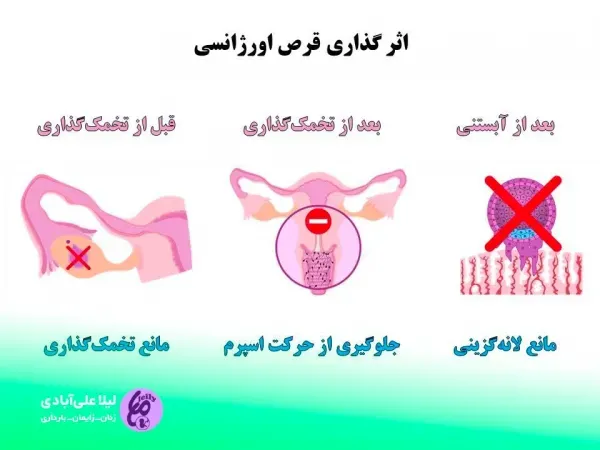  بهترین اسپری تاخیری و سفت کننده + قرص اورژانسی + احتمال بارداری با کاندوم