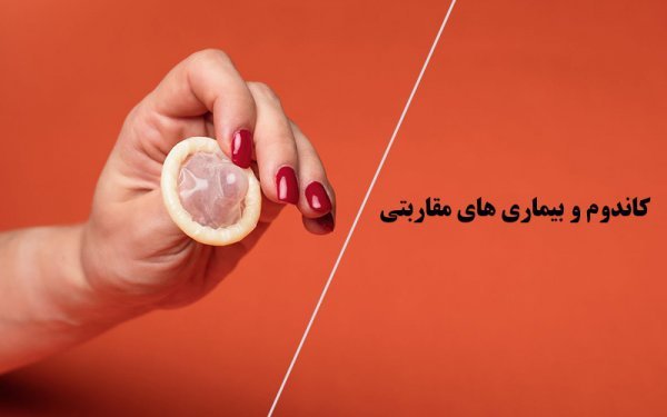  اسپری تاخیری چقدر قبل باید مصرف شود + کاندوم و دیر انزالی + کاندوم زنانه