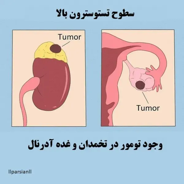  کاندوم لذت سکس را کم می‌کند + کاندوم زبانی + قرص ضد بارداری باعث یبوست می‌شود