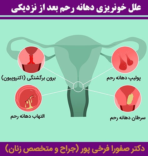 چرا بعد از سکس واژن زخم می‌شود + خشکی واژن + غسل جنابت بدون آب