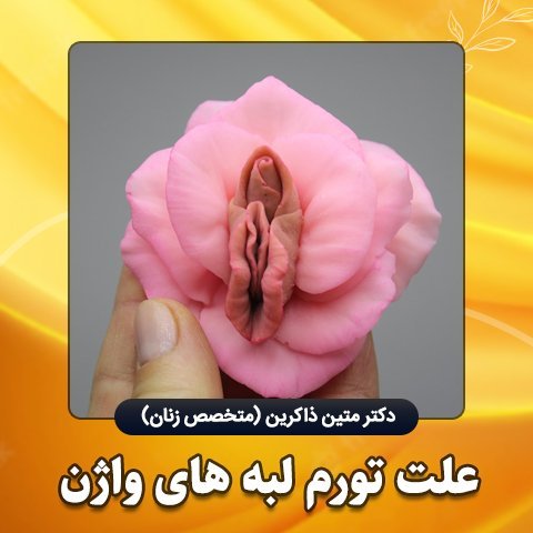  چه چیزی باعث شقاق مقعدی می‌شود + پماد برای ترک واژن-شقاق واژن