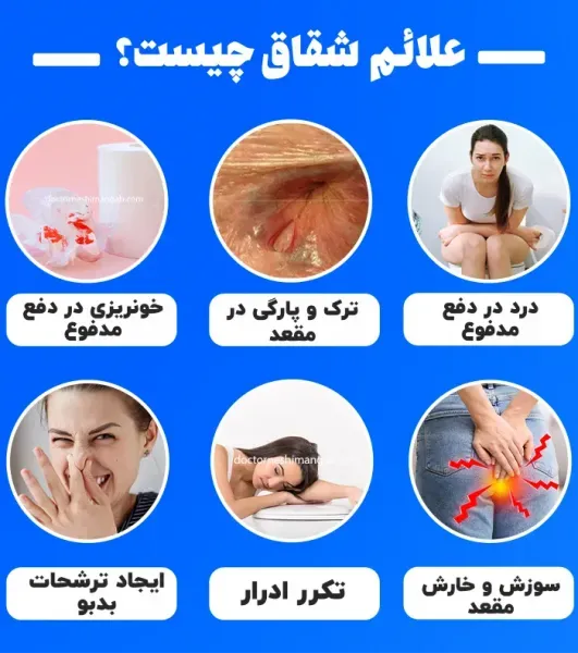  چه چیزی باعث شقاق مقعدی می‌شود + پماد برای ترک واژن-شقاق واژن