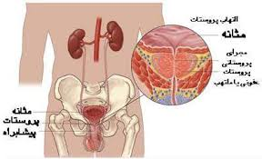  آیا در مذی اسپرم وجود دارد + چرا بعد از رابطه جنسی واژن ورم می‌کند