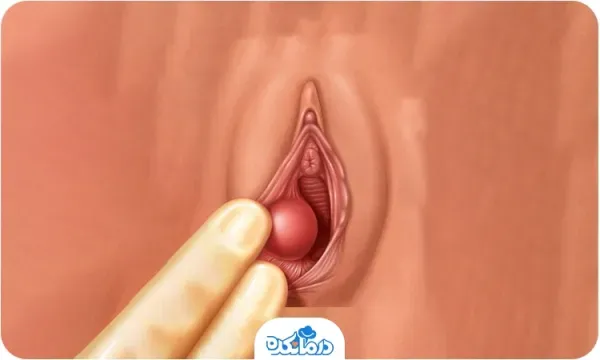  عورت زن کجاست+ناحیه ژنیتال زن+مرد در چه سنی میل جنسی‌اش کم می‌شود