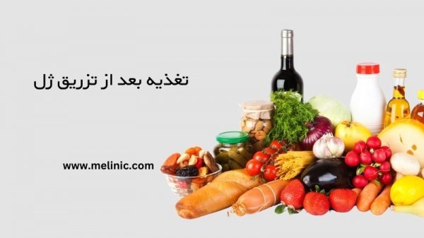 بعد از تزریق ژل صورت چی بخورم + سردرد بعد از عمل بینی تا کی ادامه دارد