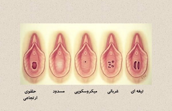  قرص تاخیری خیلی قوی امریکایی + قرص تاخیری و سفت کننده بدون عوارض