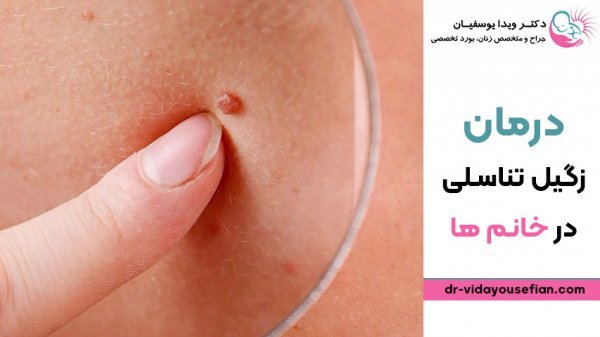  علائم پاره شدن بکارت+پارگی پرده بکارت با انگشت+ از کجا بفهمیم زگیل تناسلی داریم