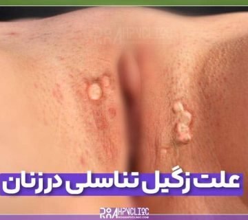  علائم پاره شدن بکارت+پارگی پرده بکارت با انگشت+ از کجا بفهمیم زگیل تناسلی داریم