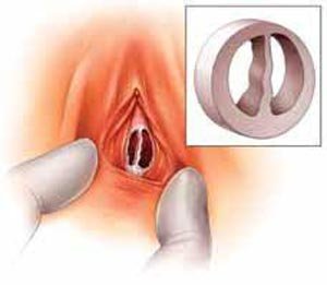  تشخیص باکره بودن دختر از روی چشم + تشخیص باکره بودن از چهره