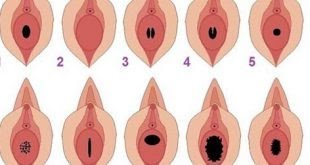  تشخیص باکره بودن دختر از روی چشم + تشخیص باکره بودن از چهره