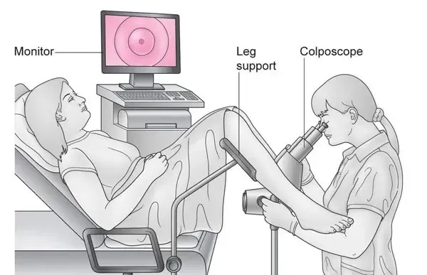  تشخیص باکره بودن دختر از روی چشم + تشخیص باکره بودن از چهره