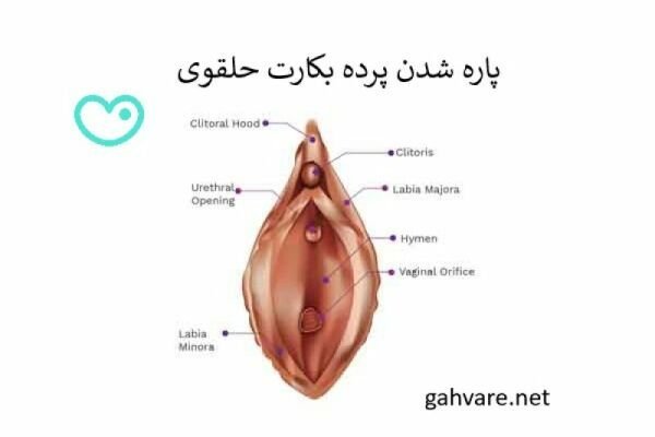 تشخیص باکره بودن دختر از روی چشم + تشخیص باکره بودن از چهره