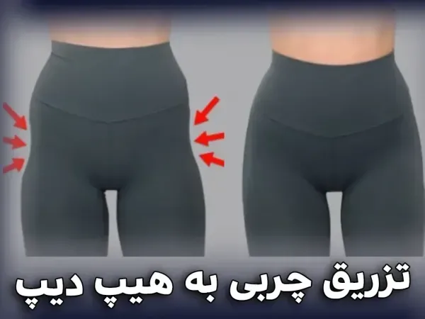  ماندگاری فیلر بیشتره یا چربی + ماندگاری فیلر بادی + تزریق چربی به هیپ دیپ