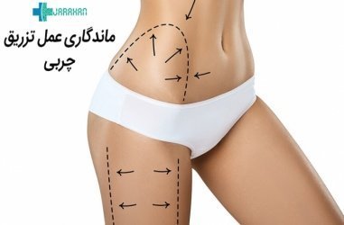  ماندگاری فیلر بیشتره یا چربی + ماندگاری فیلر بادی + تزریق چربی به هیپ دیپ