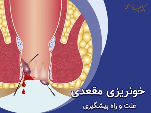  فواید ریختن اسپرم داخل رحم+حکم ارضا شدن با دست همسر+سکس مقعدی