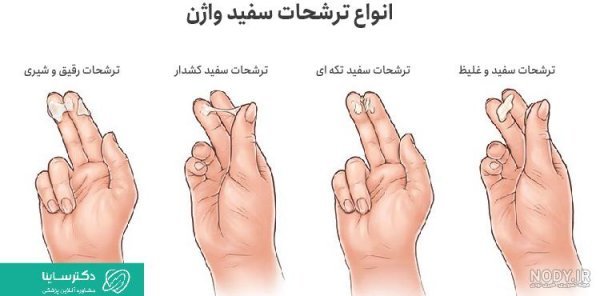  علائم بارداری بعد از ۴۸ ساعت سکس+ترشح سفید قبل از پریود نشانه بارداری است