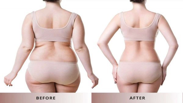  فیلم عمل جراحی شکم برای لاغری+فیلم و عکس پیکر تراشی بدون سانسور