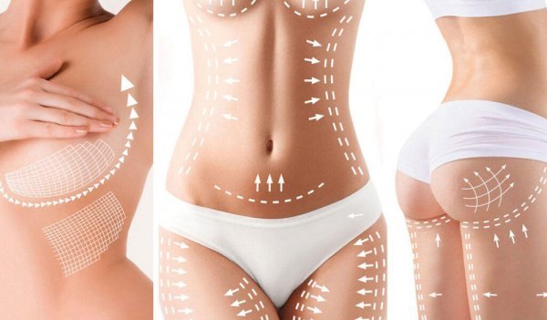  فیلم عمل جراحی شکم برای لاغری+فیلم و عکس پیکر تراشی بدون سانسور