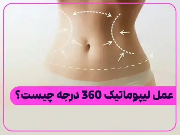  لیپو و ابدو چه فرقی دارد+عمل لیپو ابدو چقدر طول میکشد+لیپو۳۶۰ درجه یعنی چی