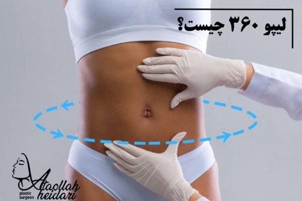  لیپو و ابدو چه فرقی دارد+عمل لیپو ابدو چقدر طول میکشد+لیپو۳۶۰ درجه یعنی چی