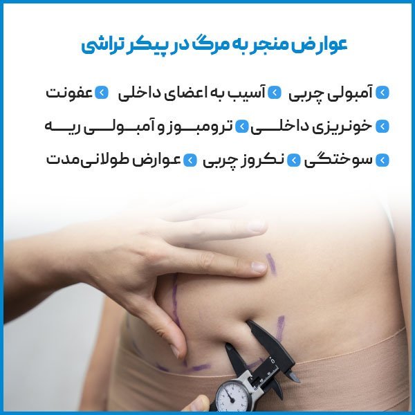  لیپو و ابدو چه فرقی دارد+عمل لیپو ابدو چقدر طول میکشد+لیپو۳۶۰ درجه یعنی چی