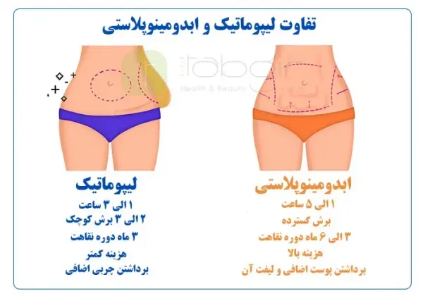 لیپو و ابدو چه فرقی دارد+عمل لیپو ابدو چقدر طول میکشد+لیپو۳۶۰ درجه یعنی چی
