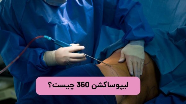  لیپو و ابدو چه فرقی دارد+عمل لیپو ابدو چقدر طول میکشد+لیپو۳۶۰ درجه یعنی چی