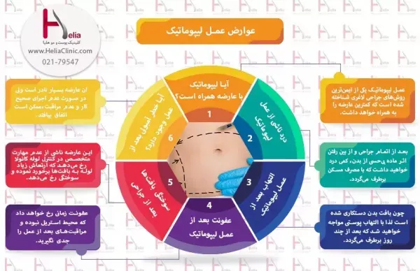  آیا لیپوماتیک خطرناک است+قبل از عمل لیپوماتیک چی بخوریم+اسلیو معده یعنی چی