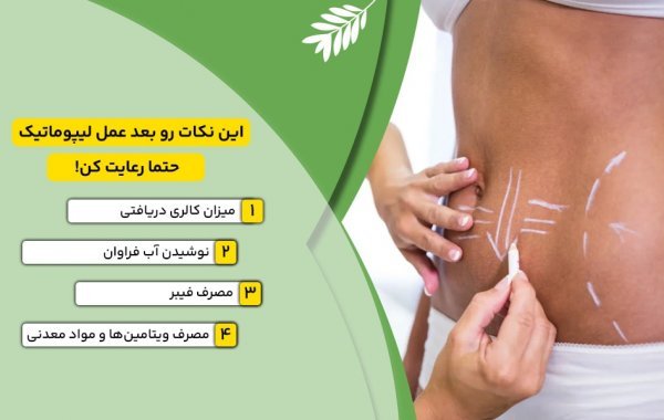  آیا لیپوماتیک خطرناک است+قبل از عمل لیپوماتیک چی بخوریم+اسلیو معده یعنی چی