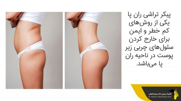  آیا لیپوماتیک بازو درد دارد+آیا لیپوماتیک ران درد دارد+بعد از اسلیو معده دوباره چاق می‌شویم+چرا بعد از عمل ابدومینوپلاستی باید گن پوشید