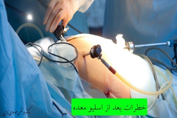  بعد از تزریق چربی صورت چه ویتامین‌هایی بخوریم+عمل اسلیو چگونه باعث لاغری میشود+آیا اسلیو معده باعث نازایی می‌شود+عوارض اسلیو معده
