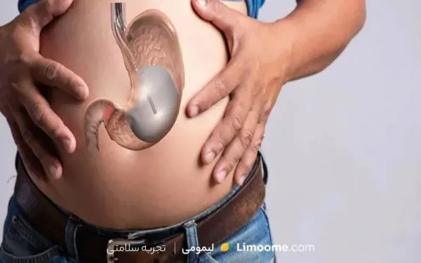  آیا بعد از اسلیو معده گشاد می‌شود+دوره نقاهت لیپوماتیک چقدر است+چه قرصی معده را کوچک می‌کند+بوتاکس معده برای چه وزنی است