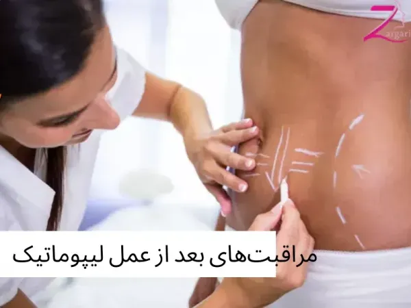  آیا بعد از اسلیو معده گشاد می‌شود+دوره نقاهت لیپوماتیک چقدر است+چه قرصی معده را کوچک می‌کند+بوتاکس معده برای چه وزنی است